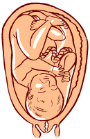 36 weeks old fetus (baby)